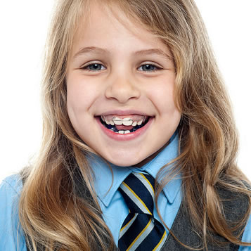 orthodontic retention